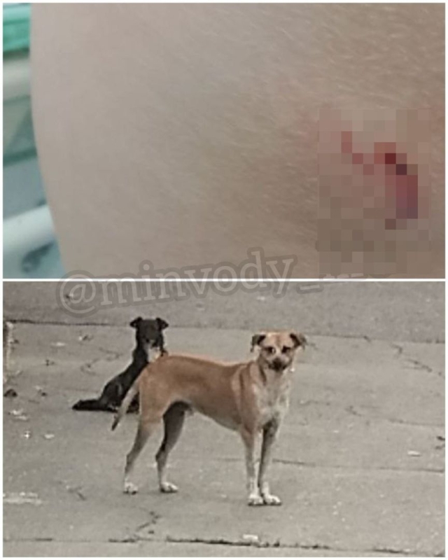 Бездомная собака укусила школьницу в Минводах